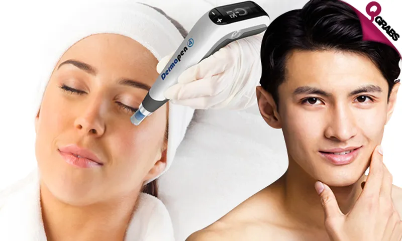 Mesotherapy OR Dermapen Sessions!